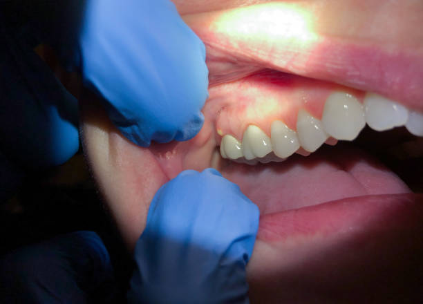Best Cosmetic Emergency Dentistry in Richgrove, CA